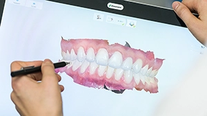 Analyse numérique du sourire pour des soins esthétiques dentaires